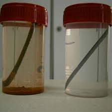 El Inhibidor de Corrosión FERCO PROTEC AQUO, fabricado por NEOQUIM, es un aditivo profesional de alto rendimiento diseñado para proteger los circuitos cerrados de agua en sistemas de calefacción, refrigeración o suelo radiante. Su innovadora formulación actúa como inhibidor de corrosión e incrustaciones calcáreas, garantizando una máxima eficiencia energética y una mayor durabilidad del sistema. Gracias a su combinación de dispersantes y desincrustantes calcáreos, inhibidores de corrosión para metales ferrosos y no ferrosos, y eliminadores de oxígeno, PROTEC AQUO previene la formación de depósitos minerales, sedimentos y gases disueltos que pueden afectar el rendimiento y provocar averías en el circuito. Este producto forma una película protectora sobre las superficies metálicas, reduce la oxidación interna y mejora la transferencia térmica, optimizando el consumo energético y minimizando los costes de mantenimiento. Es imprescindible en instalaciones mixtas o con componentes de aluminio y cobre, donde la corrosión tiende a ser más agresiva.